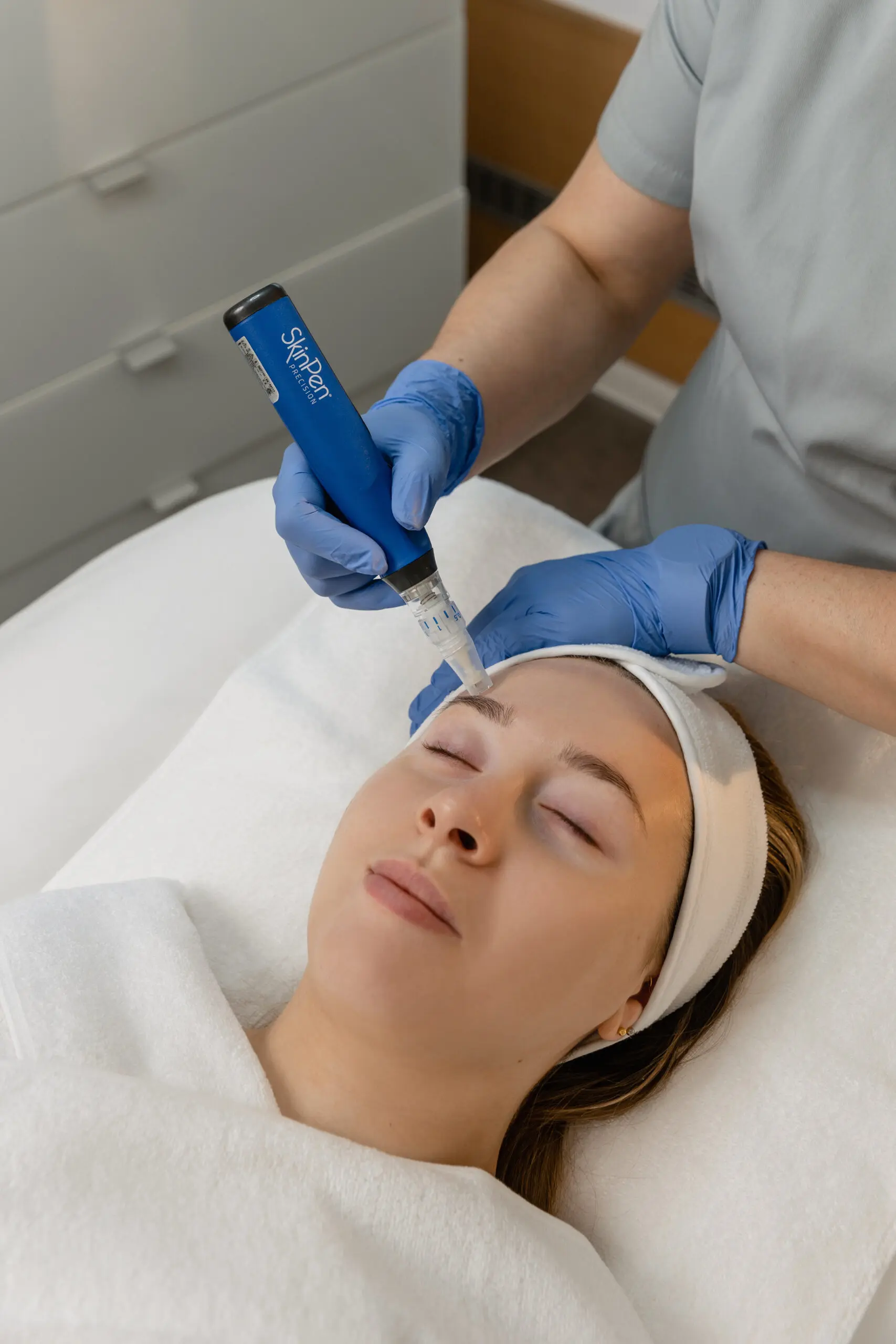 skinpen in karlsruhe mcos beauty